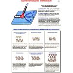 Купить Плакат: Манипулирование электродом (250 г/м2, А1, ламинированный) из серии Плакаты (различные типоразмеры)