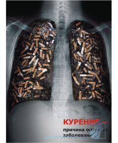 Комплект социальных плакатов (против курения, наркомании, алкоголизма) , 3 штуки, формат А3, ламинированные - Общие плакаты, Плакаты (различные типоразмеры) -  1