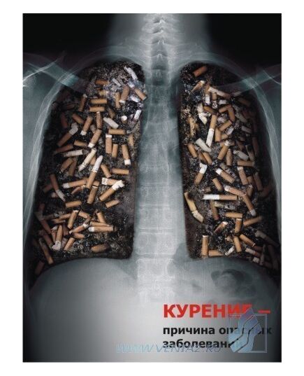 Комплект социальных плакатов (против курения, наркомании, алкоголизма) , 3 штуки, формат А3, ламинированные - Общие плакаты, Плакаты (различные типоразмеры) -  2