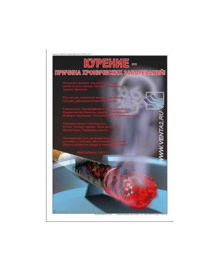 Комплект плакатов: О вреде курения, 3 штуки, формат А3, ламинированные - Охрана труда, Безопасность работ, Плакаты (различные типоразмеры) -  2